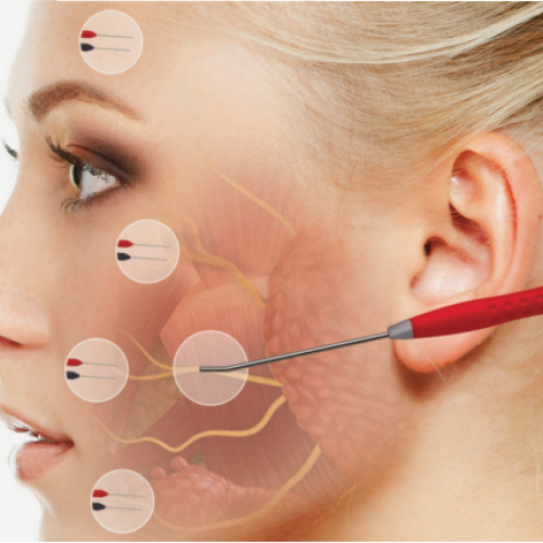 Kit Facial Eletrodo Subdermal